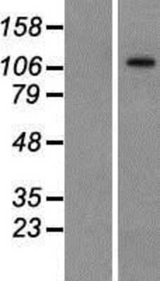 Western Blot: BTF Overexpression Lysate [NBP2-10307]