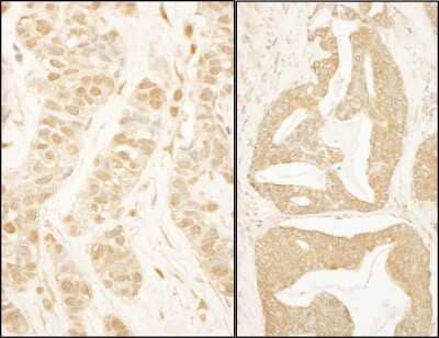 Immunohistochemistry: BTF3 Antibody [NBP1-28700]