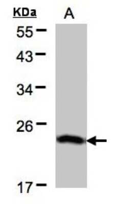 Western Blot: BTF3 Antibody [NBP1-32292]