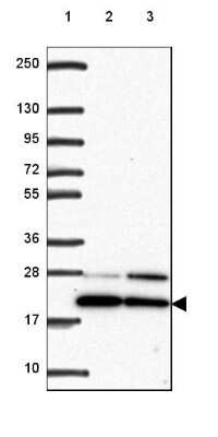 Western Blot: BTF3 Antibody [NBP2-49225]