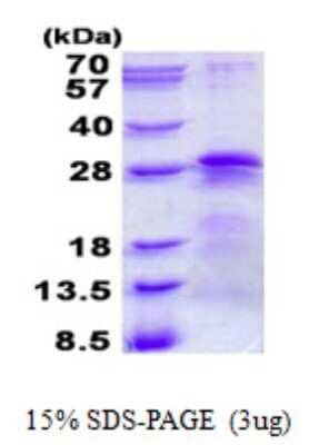 SDS-PAGE: Recombinant Human BTF3 His Protein [NBP2-22705]