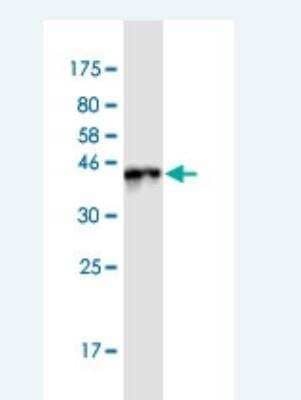 Western Blot: BTF3L4 Antibody (2G10) [H00091408-M05-100ug]