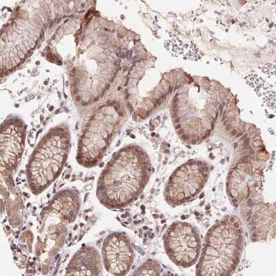 Immunohistochemistry-Paraffin: BTF3L4 Antibody [NBP2-38097]