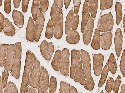 Immunohistochemistry-Paraffin: BTF3L4 Antibody [NBP2-98619]