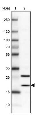 Western Blot: BTF3L4 Antibody [NBP2-38097]