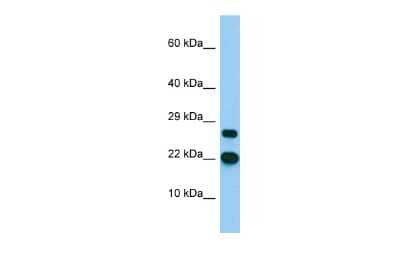 Western Blot: BTF3L4 Antibody [NBP2-84526]