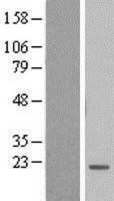 Western Blot: BTF3L4 Overexpression Lysate [NBL1-08046]