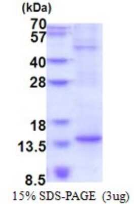 SDS-PAGE: Recombinant Human BTF3L4 His Protein [NBP2-51577]