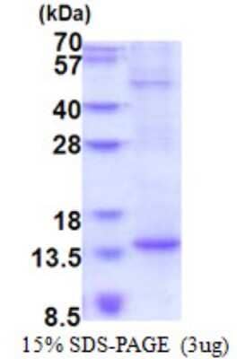 SDS-PAGE: Recombinant Human BTF3L4 His Protein [NBP2-51577]