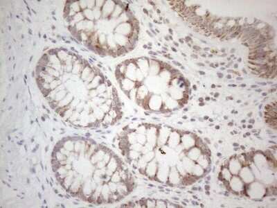 Immunohistochemistry: BTG2 Antibody (OTI4C10) [NBP2-46587]