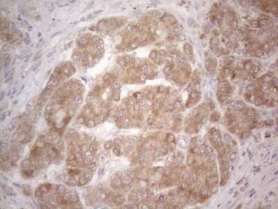 Immunohistochemistry: BTG2 Antibody (OTI4C10) [NBP2-46587]