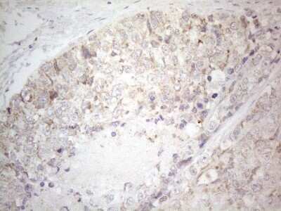 Immunohistochemistry: BTG2 Antibody (OTI4C10) [NBP2-46587]