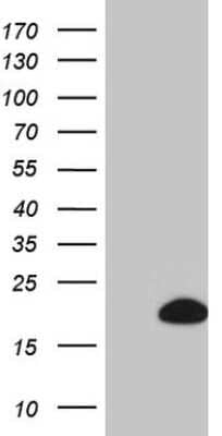 Western Blot: BTG2 Antibody (OTI4C10) [NBP2-46587]