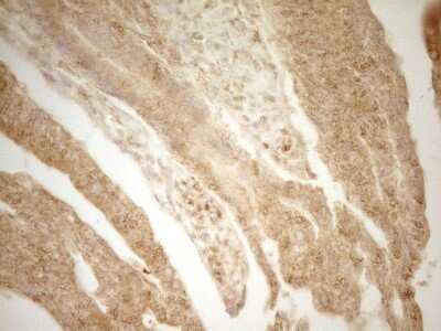Immunohistochemistry: BTG1 Antibody (OTI7H6) [NBP2-46586]