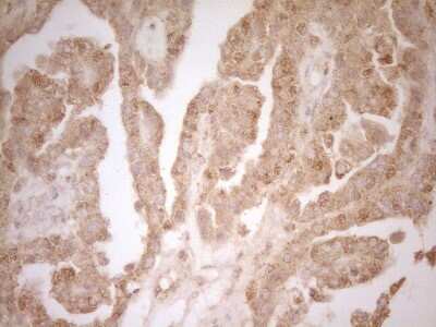 Immunohistochemistry: BTG1 Antibody (OTI7H6) [NBP2-46586]
