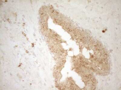 Immunohistochemistry: BTG1 Antibody (OTI7H6) - Azide and BSA Free [NBP2-70286]