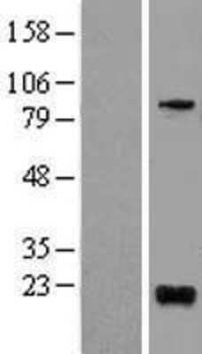 Western Blot: BTG1 Overexpression Lysate [NBL1-08047]