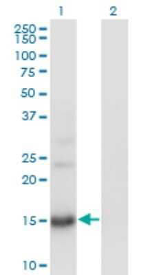 Western Blot: BTG2 Antibody (1A5) [H00007832-M01]