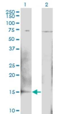 Western Blot: BTG2 Antibody (1B8) [H00007832-M02]