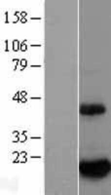 Western Blot: BTG2 Overexpression Lysate [NBL1-08048]