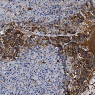 Immunohistochemistry-Paraffin: BTG3 Antibody [NBP1-89098]