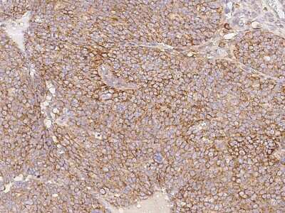 Immunohistochemistry-Paraffin: BTG3 Antibody [NBP2-99254]