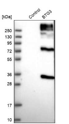 Western Blot: BTG3 Antibody [NBP1-89098]