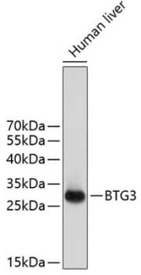 Western Blot: BTG3 AntibodyAzide and BSA Free [NBP3-05196]