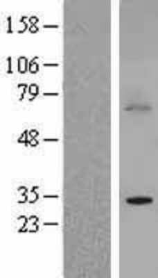 Western Blot: BTG3 Overexpression Lysate [NBL1-08049]