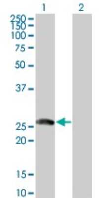 Western Blot: BTG4 Antibody (1A6) [H00054766-M07]