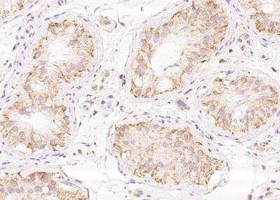 Immunohistochemistry-Paraffin: BTG4 Antibody [NBP3-05926]