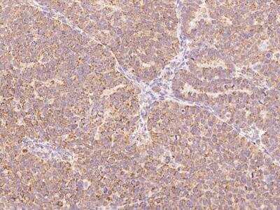 Immunohistochemistry-Paraffin: BTG4 Antibody [NBP3-05926]