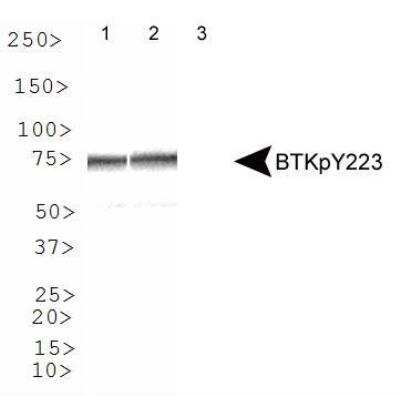 Western Blot: BTK [p Tyr223] AntibodyBSA Free [NBP1-78295]