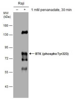 Western Blot: BTK [p Tyr223] Antibody [NBP3-12916]