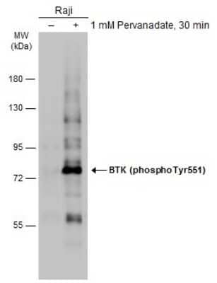 Western Blot: BTK [p Tyr551] Antibody [NBP3-13261]