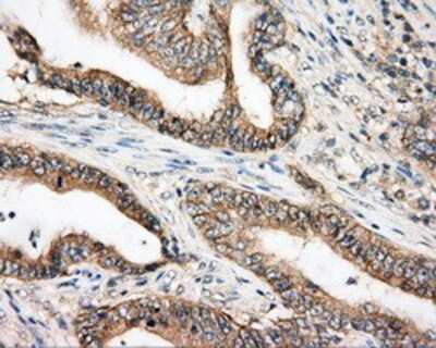 Immunohistochemistry-Paraffin: BTK Antibody (OTI3A2) [NBP2-02472]