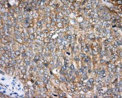 Immunohistochemistry-Paraffin: BTK Antibody (OTI3A2) [NBP2-02472]