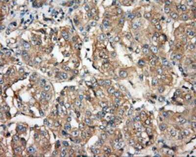 Immunohistochemistry-Paraffin: BTK Antibody (OTI3A2) [NBP2-02472]