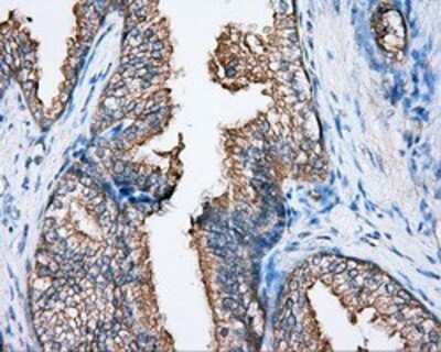 Immunohistochemistry-Paraffin: BTK Antibody (OTI3A2) [NBP2-02472]