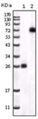 Western Blot: BTK Antibody (7F12H4)Azide and BSA Free [NBP2-80605]