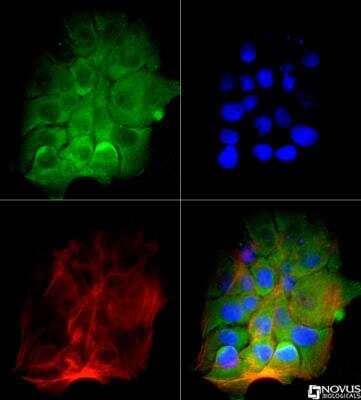 Immunocytochemistry/ Immunofluorescence: BTK Antibody (7F12H4) - BSA Free [NB110-87047]