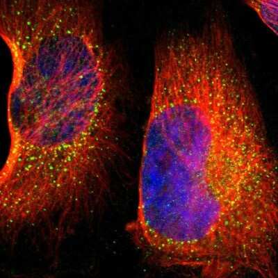 Immunocytochemistry/ Immunofluorescence: BTK Antibody [NBP1-89207]