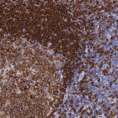 Immunohistochemistry-Paraffin: BTK Antibody [NBP1-89207]