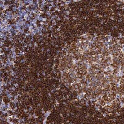 Immunohistochemistry-Paraffin: BTK Antibody [NBP1-89207]