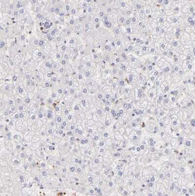 Immunohistochemistry-Paraffin: BTK Antibody [NBP1-89206]