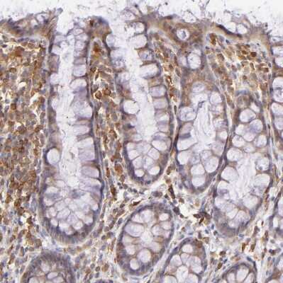 Immunohistochemistry-Paraffin: BTK Antibody [NBP1-89206]