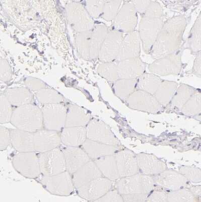 Immunohistochemistry-Paraffin: BTK Antibody [NBP1-89206]