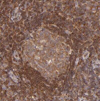 Immunohistochemistry-Paraffin: BTK Antibody [NBP1-89206]