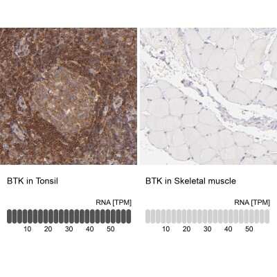 Immunohistochemistry-Paraffin: BTK Antibody [NBP1-89206]
