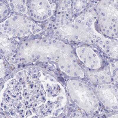 Immunohistochemistry-Paraffin: BTK Antibody [NBP1-89207]